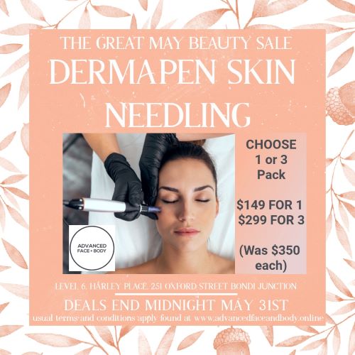 MAY SPECIAL - DERMAPEN SKIN NEEDLING SALE Choose from One or Three Treatments