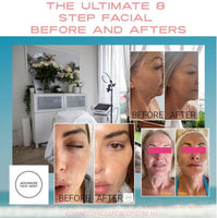 MAY SPECIAL - THE ULTIMATE 8 STEP MEDI-SPA FACIAL TREATMENT