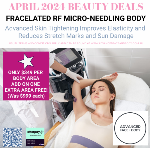 APRIL 24 - FRACELATED RF MICRO-NEEDLING - SKIN TIGHTENING & REJUVENATION TREATMENT - BUY ONE AREA, GET ONE FREE SALE!