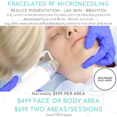 AUGUST 25 - FRACELATED RF MICRO-NEEDLING TREATMENT (Treats wrinkles, acne, scars, pores, stretch marks & tightens loose skin