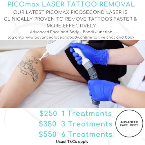 AUGUST 25 - PICOmax LASER TATTOO REMOVAL TREATMENT