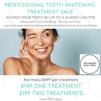 AUGUST 25 DEALS - TEETH WHITENING TREATMENT - Whiten Your Teeth By Up To 5 Shades Only $199 (normally $499)