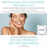 AUGUST 25 DEALS - TEETH WHITENING TREATMENT - Whiten Your Teeth By Up To 5 Shades Only $199 (normally $499)