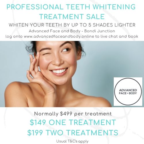 AUGUST 25 DEALS - TEETH WHITENING TREATMENT - Whiten Your Teeth By Up To 5 Shades Only $199 (normally $499)