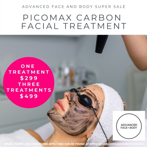 Oct 25 - PICOmax Carbon Facial Treatment (Treats sun damage and pigmentation)