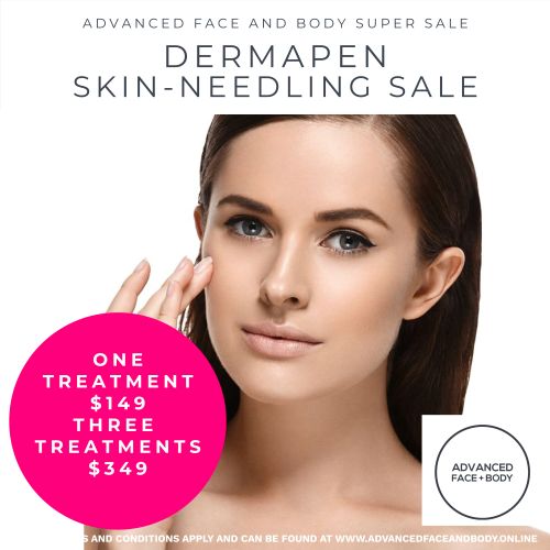 Oct 25 - Dermapen Skin Needling Treatment Sale