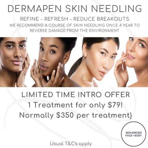 $79 INTRO OFFER Dermapen Skin Needling Treatment for first-time clients