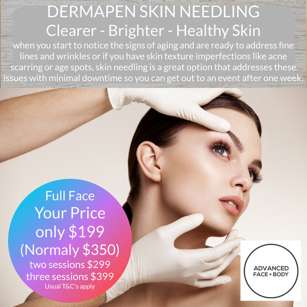JULY 24 DEAL - DERMAPEN SKIN NEEDLING  Choose from One, Two or Three Treatments