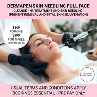 MAR 25 - DERMAPEN SKIN NEEDLING - Choose from One or Three Treatments