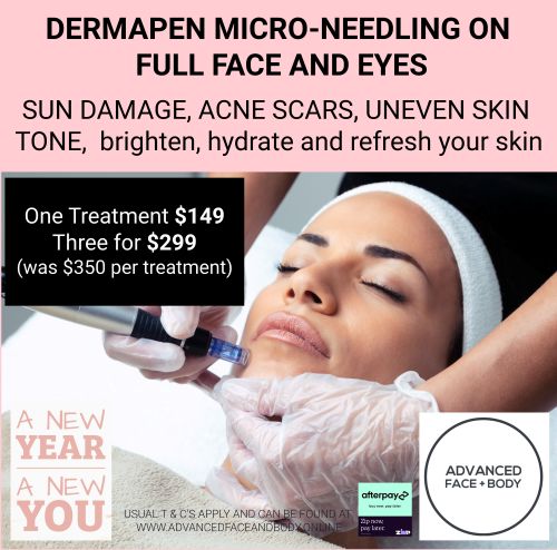 FEB 25 - DERMAPEN SKIN NEEDLING - Choose from One or Three Treatments