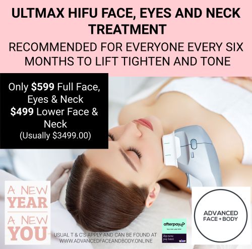 FEB 25 - 'ULTMAX' HIFU FACELIFT TREATMENT - THE ESSENTIAL NON SURGICAL FACELIFT