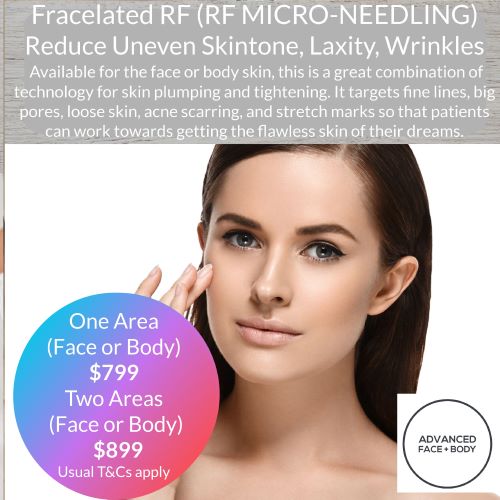 FRACELATED RF MICRO-NEEDLING TREATMENT (Treat wrinkles, tighten loose skin, acne, scars, pores & stretch marks)