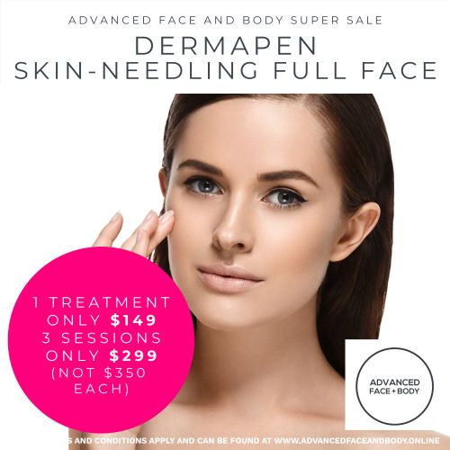 SKIN NEEDLING DERMAPEN SALE - Choose from One or Three Treatments