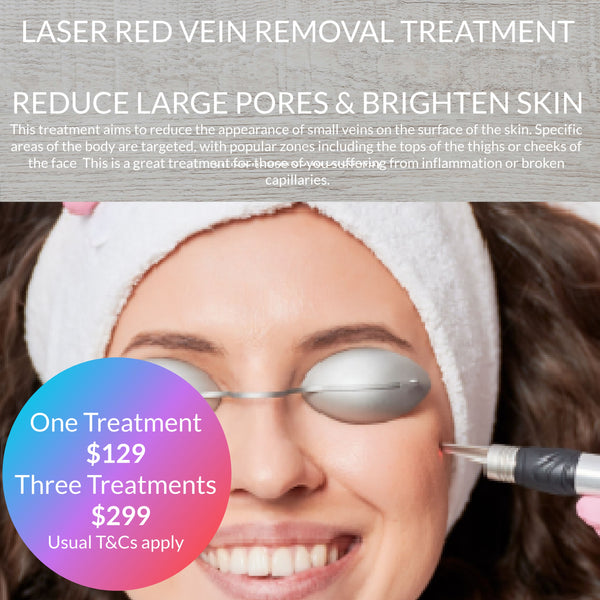 JULY 24 DEAL - LASER RED VEIN REMOVAL TREATMENT