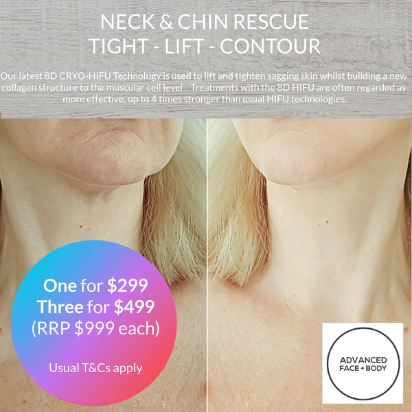 JULY 24 DEAL - THE ULTIMATE NECK & JOWL TREATMENT - 8D HIFU TIGHTENING TREATMENT