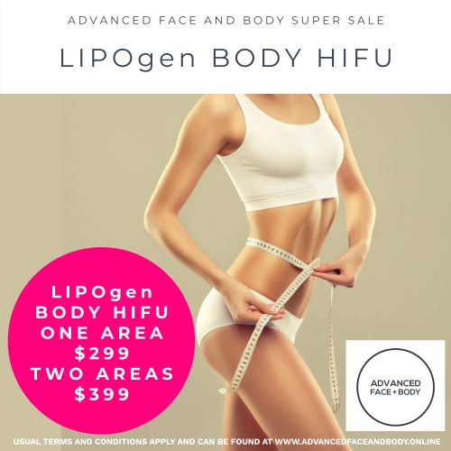Oct 25 -  LIPOgen HIFU BODY SCULPTING, MELT FAT & TIGHTEN SKIN (Normally $998 per area)