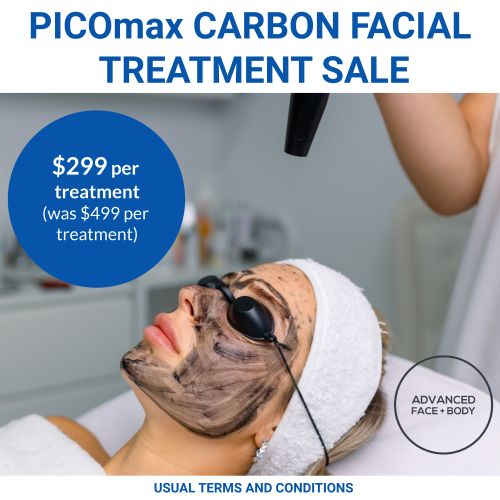 NOV 25 - PICOmax Carbon Facial Treatment (Treats pigmentation, sun damage)