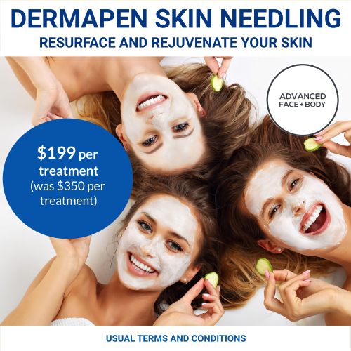 NOV 25 - Dermapen Skin Needling Treatment Sale