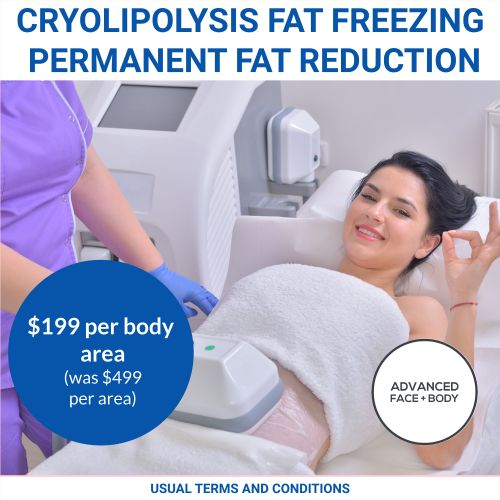 NOV 25 - Cryolipolysis Fat Freezing Treatment Sale