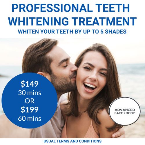 NOV 25 - Professional Teeth Whitening Treatment Sale