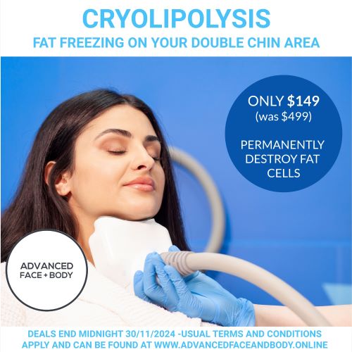 NOVEMBER 24 - DOUBLE CHIN CRYOLIPOLYSIS FAT FREEZING  - Contour your chin & jawline area