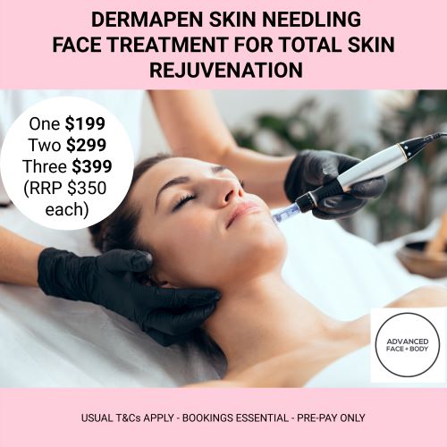 OCTOBER 24 - DERMAPEN SKIN NEEDLING  Choose from One, Two or Three Treatments