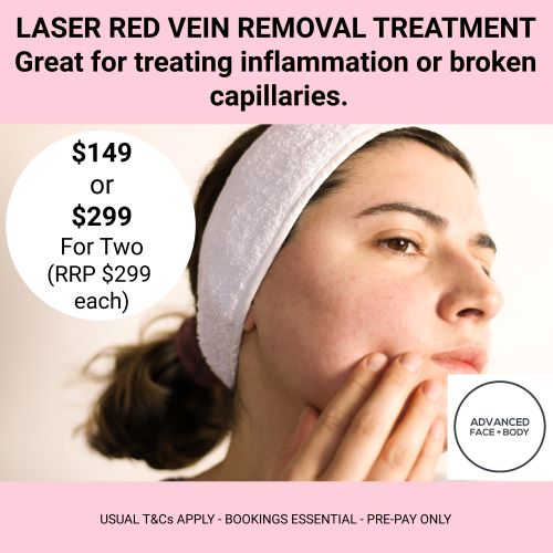 OCTOBER 24 - LASER RED VEIN REMOVAL - Choose from One or Three Treatments