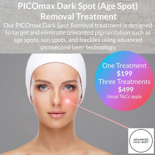 PICOmax Dark Spot (Age Spot) Removal Treatment