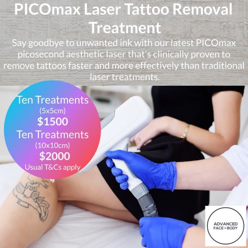 PICOmax Laser Tattoo Removal Treatment
