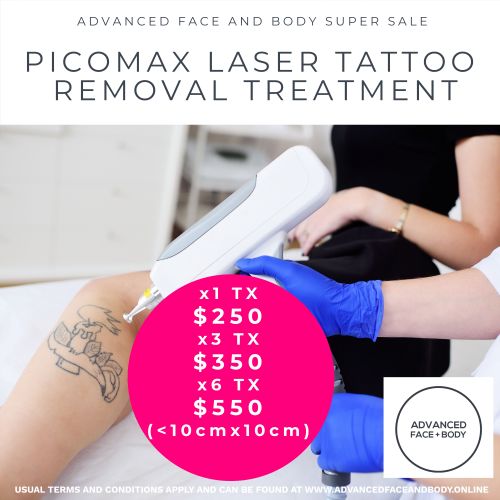 Oct 25 - PICOmax Laser Tattoo Removal Treatment