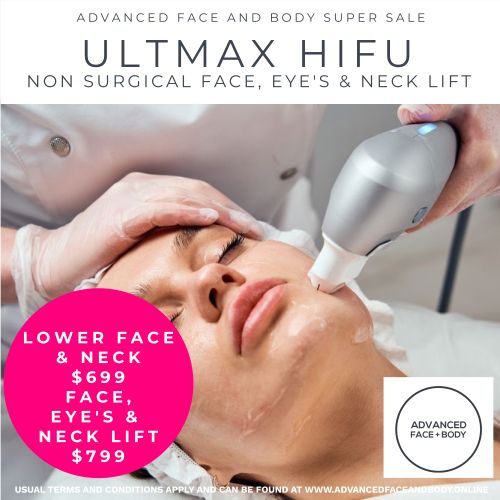 Oct 25 - 'ULTMAX' HIFU Facelift Treatment - Non surgical Facelift