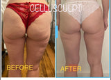 $79 INTRO OFFER CelluSculpt EMS Treatment for first-time clients