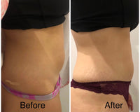 OFFER $399 LIPOGEN BODY HIFU - LIMITED TIME INTRO OFFER FOR FIRST TIME CLIENTS -LIPOgen HIFU Permanent Fat Melting and Skin Tightening Treatment Only $399 (Not $998) on one area or $499 for two areas (Not $1,996)